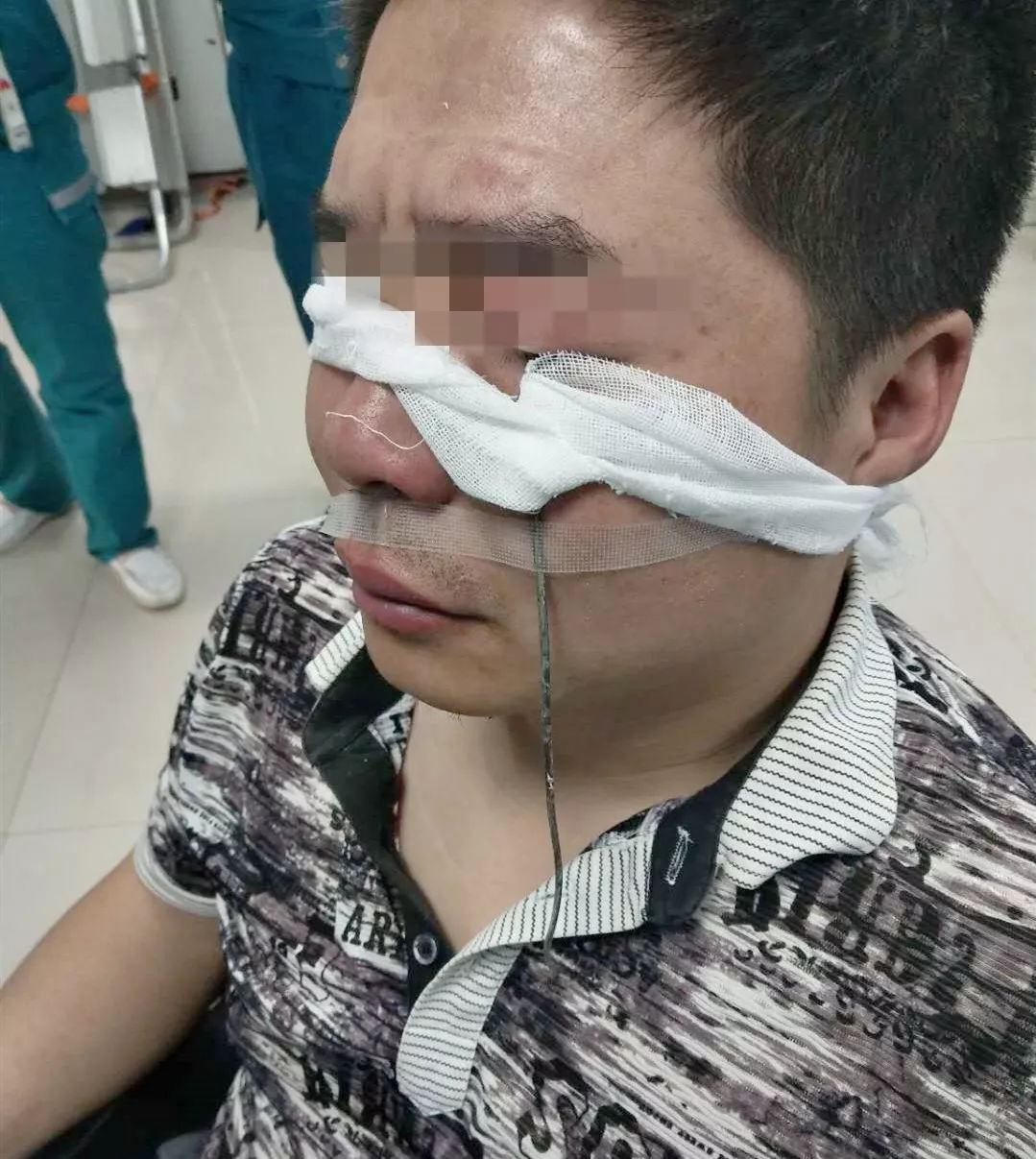 男子拆快递遭遇玻璃纤维偷袭，眼部受伤紧急处理指南