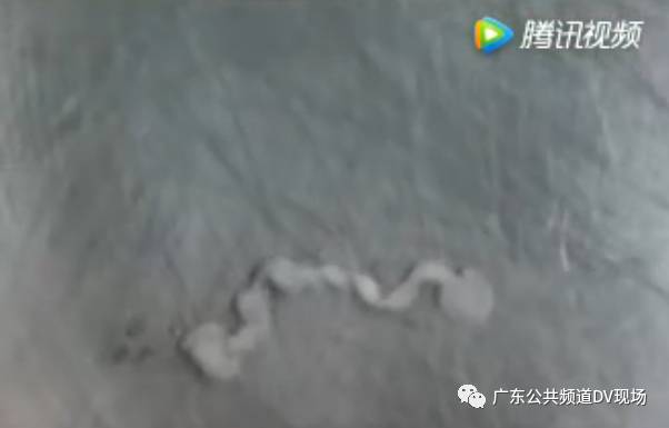 颅内寄生虫活8年，深度解析与应对之道