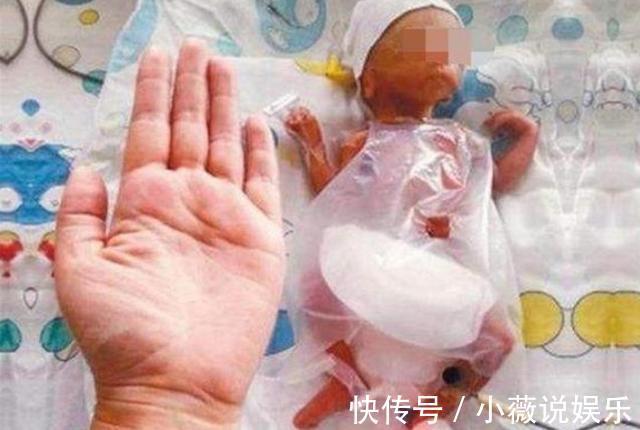 世纪婴儿是什么意思