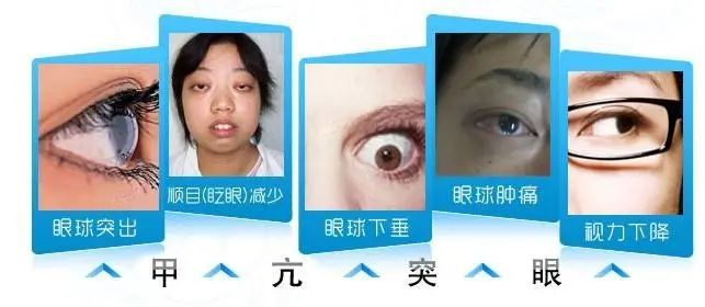 甲亢UP主的心路历程