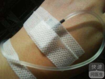 头孢输液过敏死亡案例深度解析