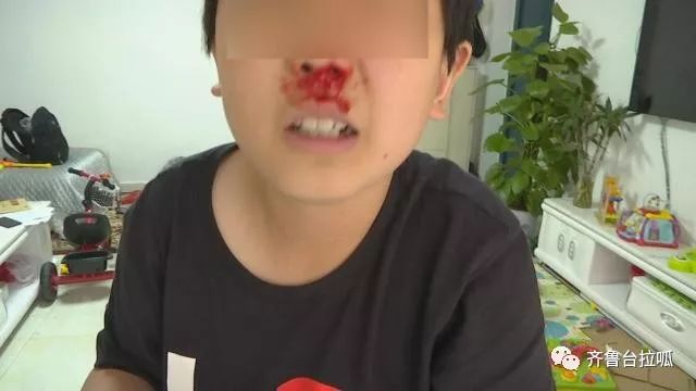 戴能量石三个月引发流鼻血现象探究