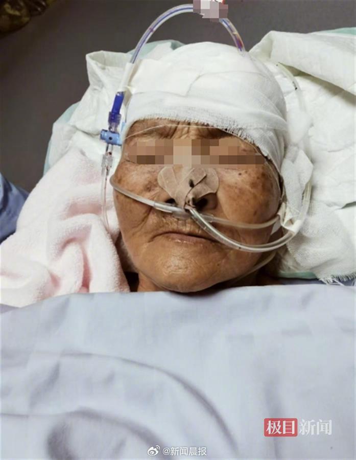护女被打成90岁脑龄事件深度解析