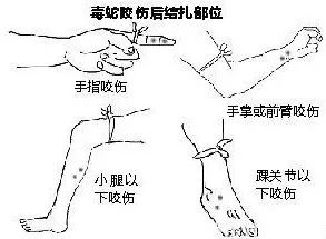 被蛇咬反抓蛇再遭咬，一场意外的冒险之旅