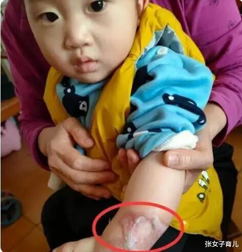 婴儿被酒熏的反应
